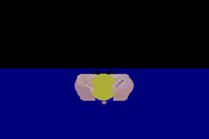 170833gw6aww33ojpevta4.gif